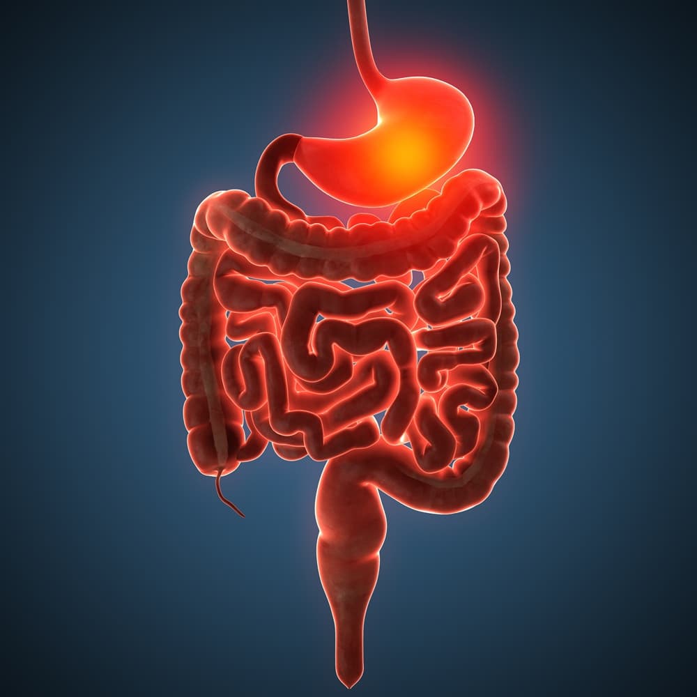 Anal Fissure